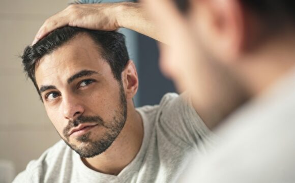 Hair Transplant